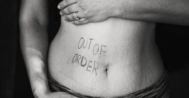 Zwillingsratgeber schwangerschaftsstreife-schwangerschaft-body-shaming-375x195 Interview mit Drillingsmama Sandra 