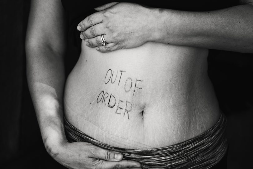 Zwillingsratgeber schwangerschaftsstreife-schwangerschaft-body-shaming-810x541 Jetzt reicht’s! – Schluss mit Body-Shaming während der Schwangerschaft und nach der Geburt 